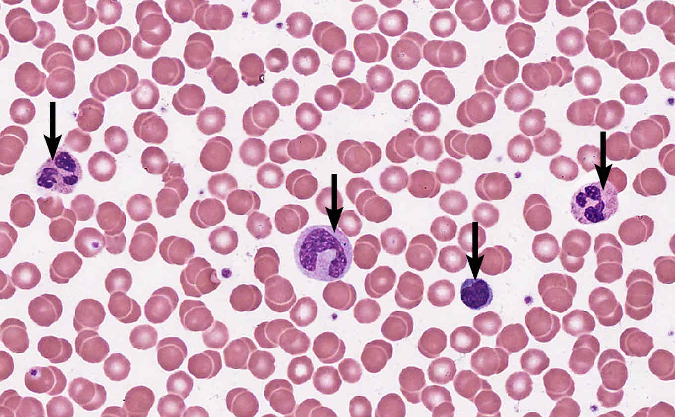 <p><span style="font-family: Cambria, serif"><strong><em>Note: Know relative prevalence and size of leukocytes</em></strong></span></p>