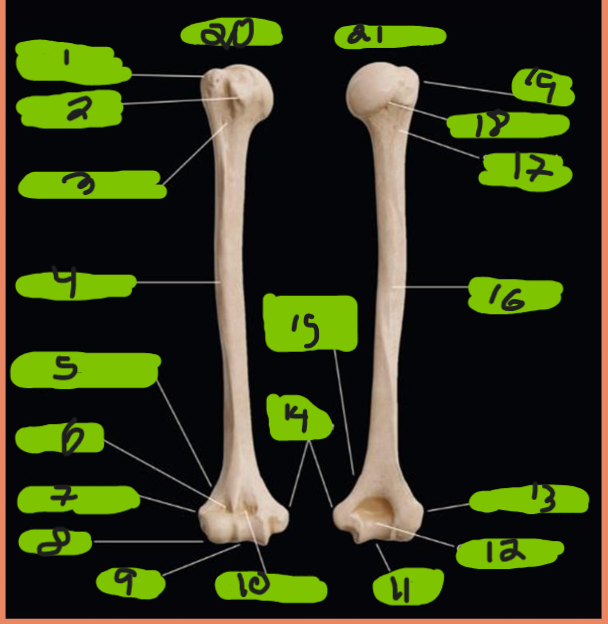 <p>what is the view of the right bone</p>