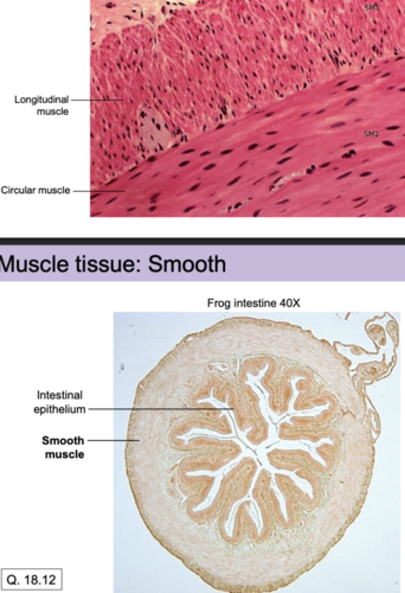 <p>yes, i can label a cross section</p>