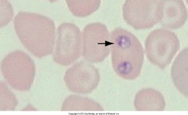 <p>canine I. host ticks within the RBCs icterus hemoglobinuria hemoglobinemia weakness diagnose stained blood smears death can occur rapidly</p>