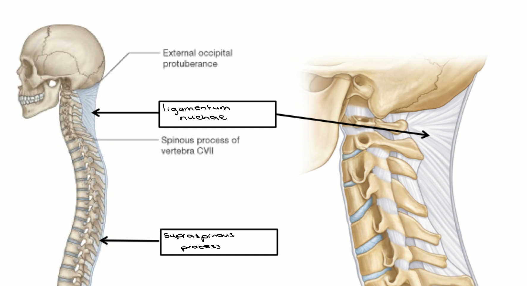 <p>It lies on top of the spinous processes. It is like a cord that runs from C7 spinous processes down to the sacrum. After C7 this ligament forms a larger ligament called the ligamentum nuchae</p><p>Position: posterior</p><p>Function: limits flexion</p>