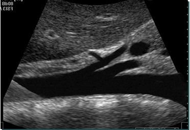 <p>In this sagittal view, what is the structure in this image?</p>