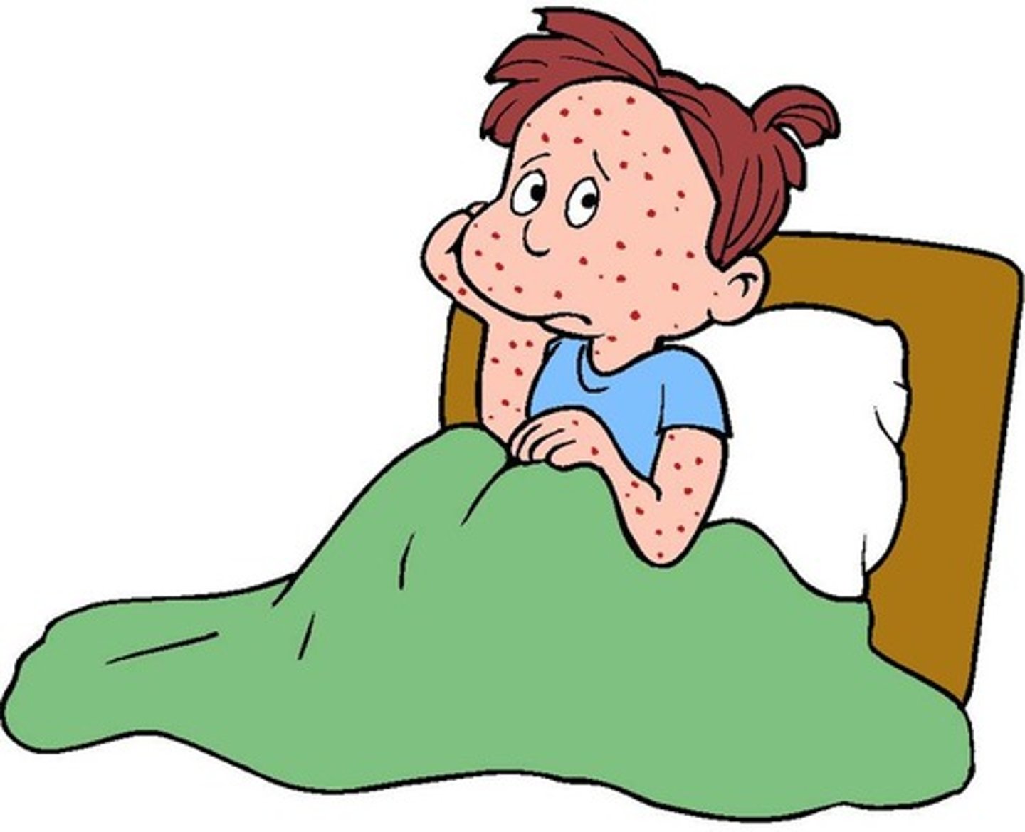 <p>Phát ban (dấu hiện trên da) - an area of small red spots on your skin that is caused by an illness or a reaction to something: <br>Eg: I think I'm allergic to that new washing powder because I've got a rash on my legs.</p>