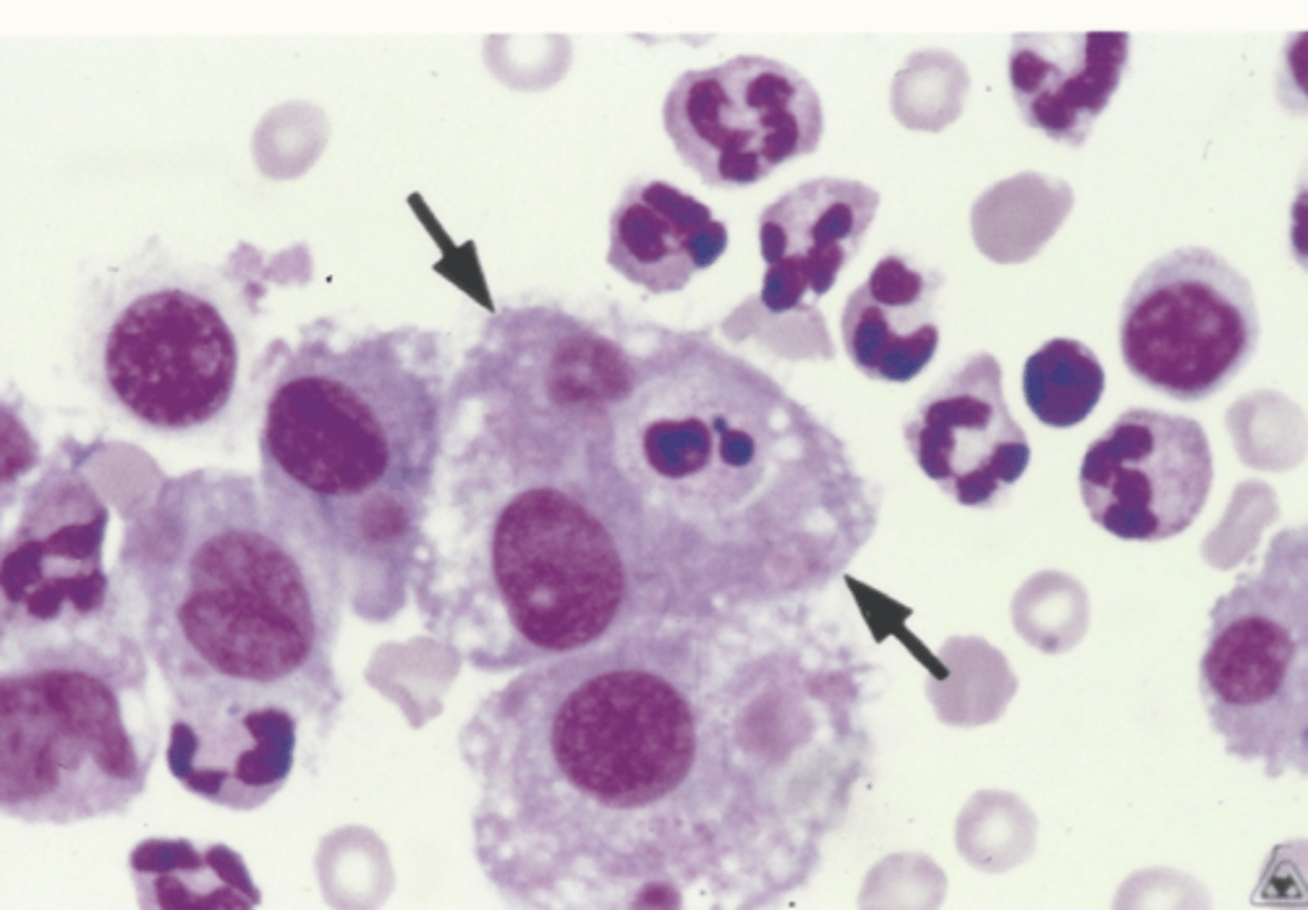 <p>Identify the cells in this body fluid</p>