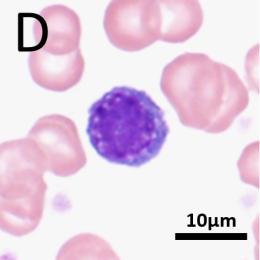<p>what WBC is the big one? what is its cell type? functions?</p>