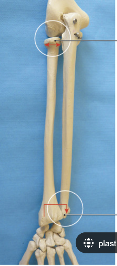<p>What is the arrow/circled joint near the elbow called?</p>