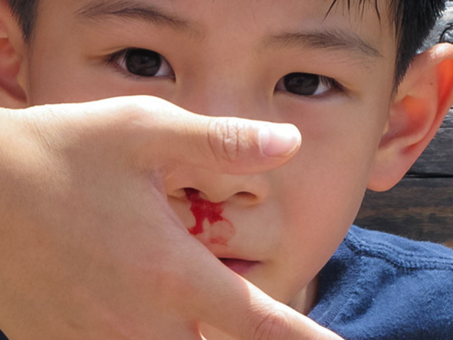 <p>1) Increased bleeding (common in malabsorptive patients and newborns)</p><p>2) Poor bone growth</p>