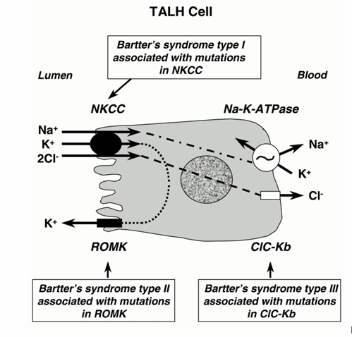<p>-genetic disease resembling chronic furosemide use</p>