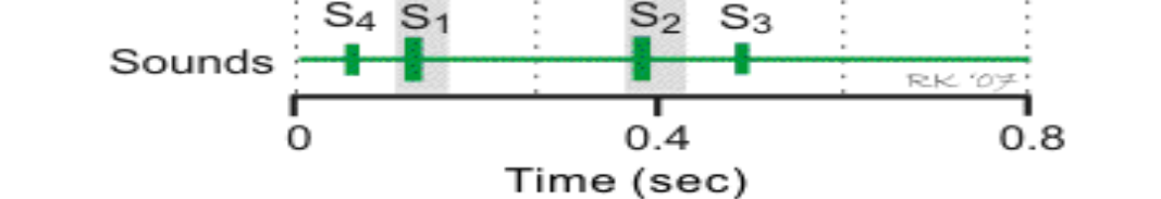 <p>When we talk about the sounds of the heart, what causes S2?</p>