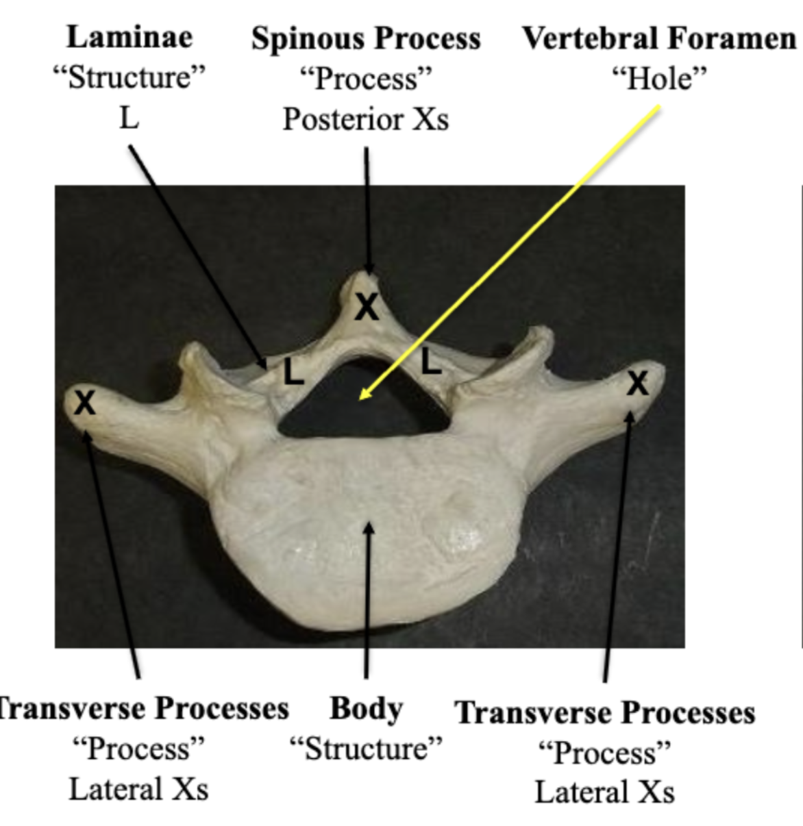 <p>Spinous Process </p>