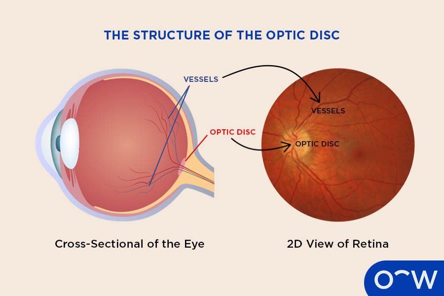 <p><span>What is the blind spot of the eye?</span></p>