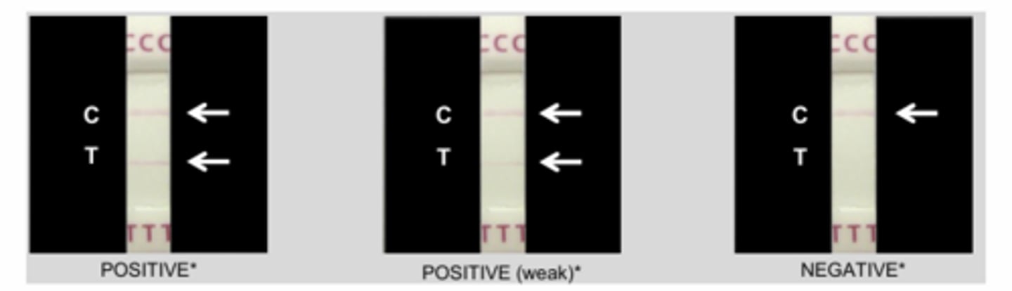 <p>Alere Filariasis Test Strip (FTS) for the qualitativedetection ofWuchereria bancroftiantigen</p><p>- BrugiaRapid point-of-care cassette test (BRT)to detect IgG4 antibody</p><p>- PCR methods to detect microfilarialDNA</p>