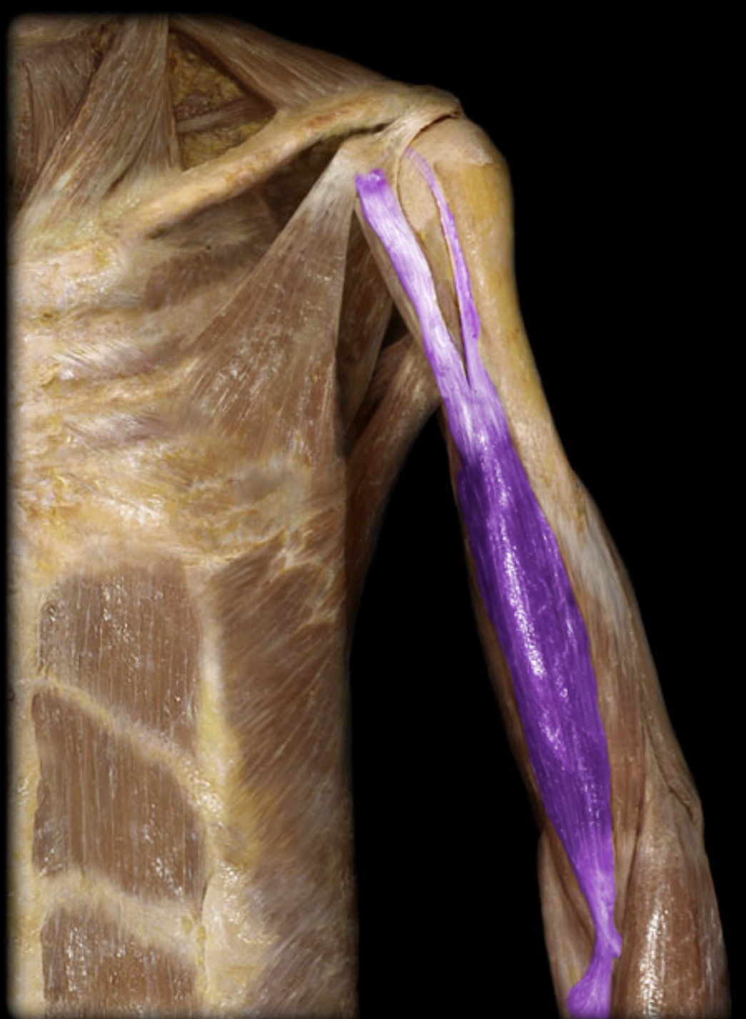 <p>What is the action of this muscle?</p>