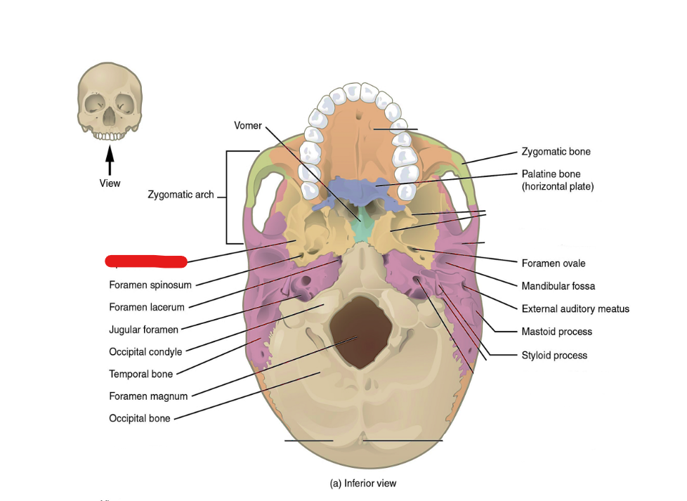 term image