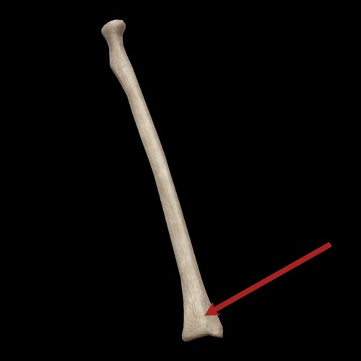 <p>large bump on the posterior surface of the distal end, radius</p>