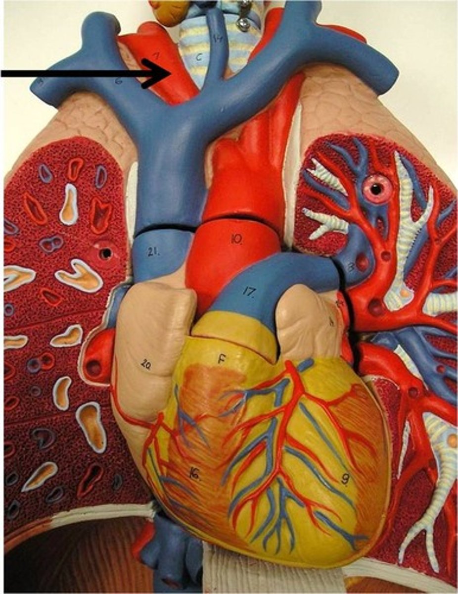 <p>► Arises directly off of the aortic arch (1st branch)</p><p>► A single vessel that gives rise to:</p><p>◦ 1. R subclavian artery</p><p>◦ 2. R CCA</p>