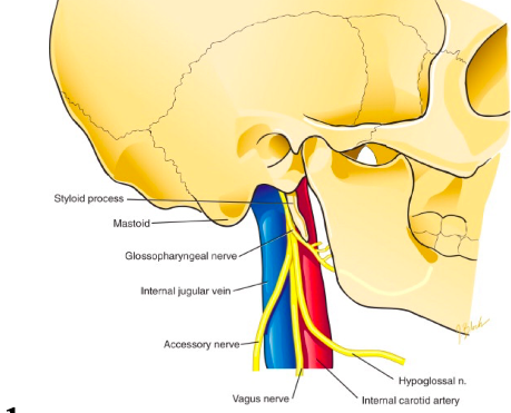 Mixed motor and sensory 

\
The glossopharyngeal nerve (CN IX) emerges from the medulla oblongata and passes through the jugular foramen. 

Branches:


1. Tympanic Nerve - Sensory to the tympanic cavity and secretomotor to the parotid gland (senses pain in otis media)
2. Branch to the Carotid Sinus - Sensory to both the carotid sinus and carotid body
3. Pharyngeal Branch - This branch unites with branches from the vagus and sympathetic trunk to form the pharyngeal plexus. Pharyngeal branch of the glossopharyngeal nerve is sensory to the pharynx.

   
   1. Senses pain in acute pharyngitis 
   2. Afferent limb of the gag reflex (CN IX)
4. Branch to the Stylopharyngeus - Motor to the stylopharyngeus muscle 
5. Tonsillar Branch - Sensory tot he mucous membrane over the tonsil and to the soft palate.

   
   1. Senses pain in tonsils
6. Lingual Branch - Supplies taste and general sensation to the posterior third of the tongue. 

\
\
