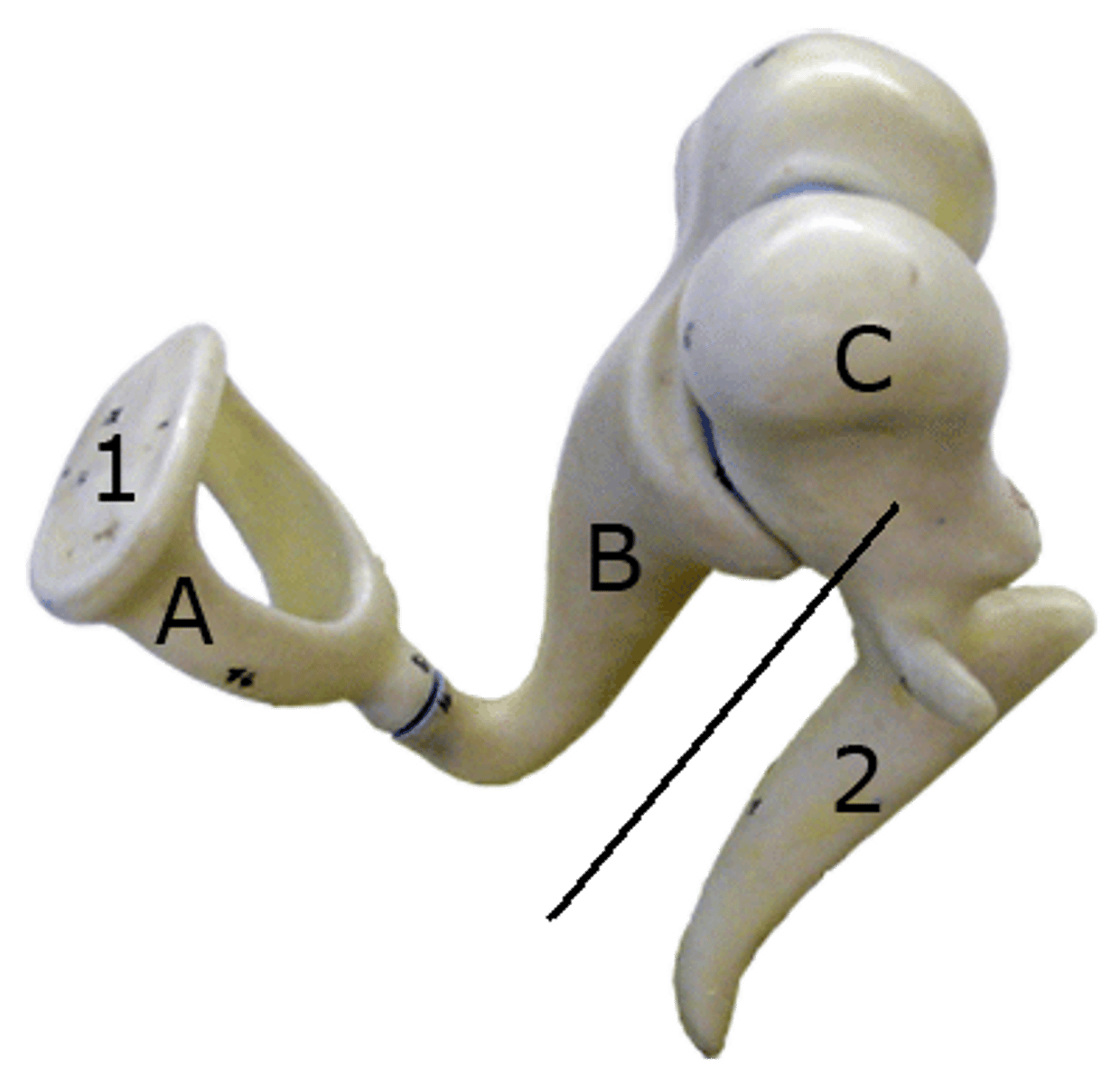 <p>DEFINITION</p><p>First ossicle (from ear drum to cochlea)</p>