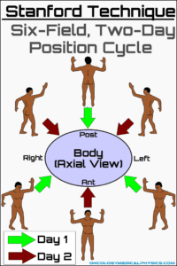 <p>60</p><p>FYI:</p><p>Typical TSI = Stanford Technique </p><p>Which is 6 fields are 60 degrees apart </p>