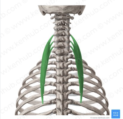 <p><em>table 3, pink color, most lateral of erector spinae on neck</em></p>