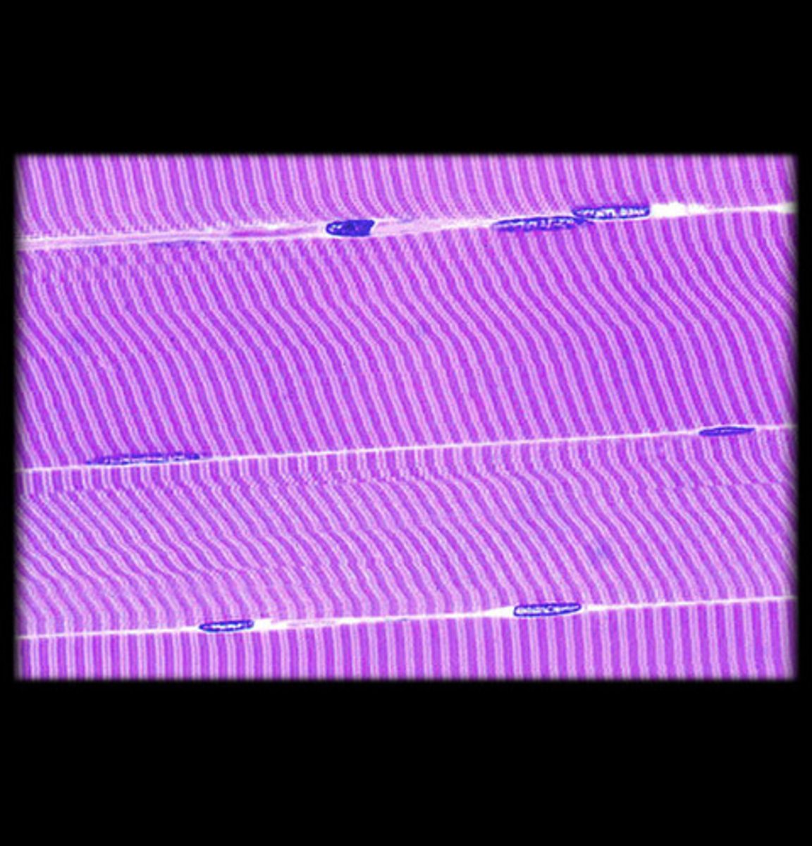 <p>- Striated, voluntary muscle.</p><p>- Long, cylindrical cells with multiple peripheral nuclei.</p><p>- Visible striations (alternating light and dark bands) due to the arrangement of actin and myosin filaments.</p><p>- Appears as parallel bundles of long fibers with clear striations under the microscope.</p><p>- Found attached to bones for voluntary movement.</p>