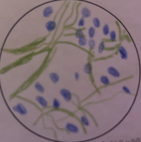 <p>nonsmooth polygonal shapes with many spine-like projections emerging from it. The nucleus is visible.</p>