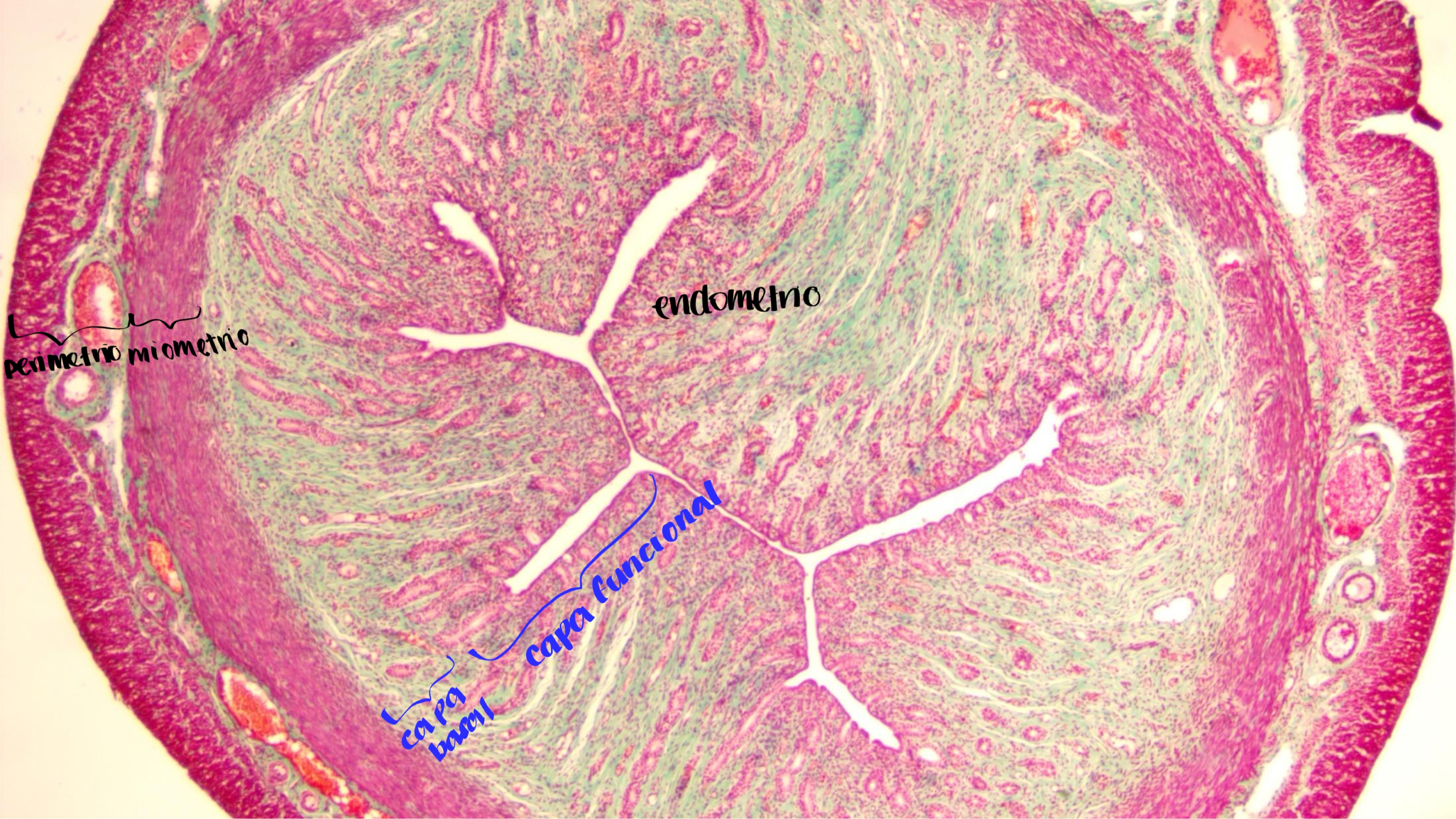 <p>utero de gato </p>