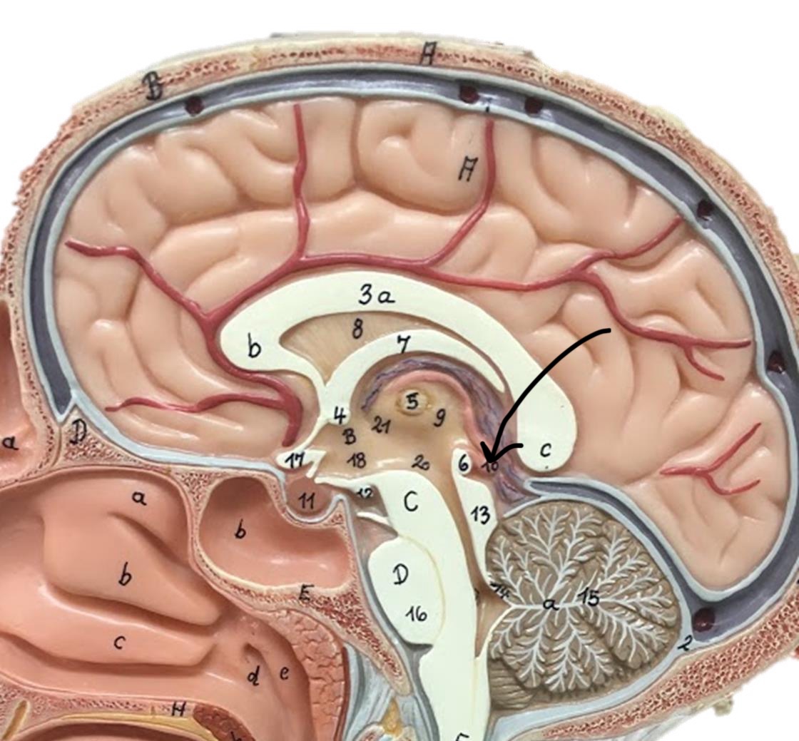 term image