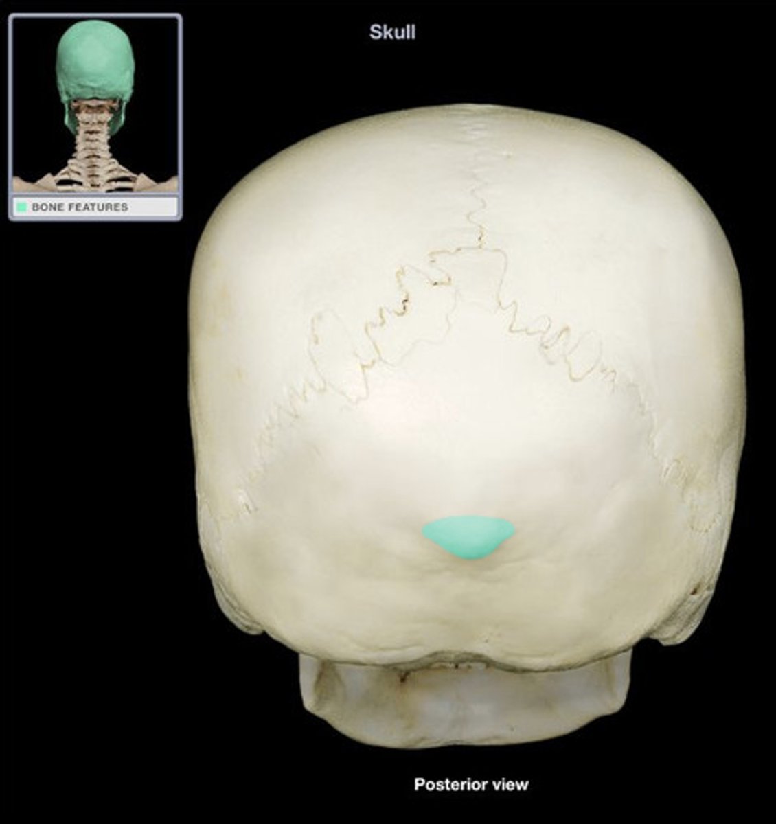 <p>occipital bone</p>