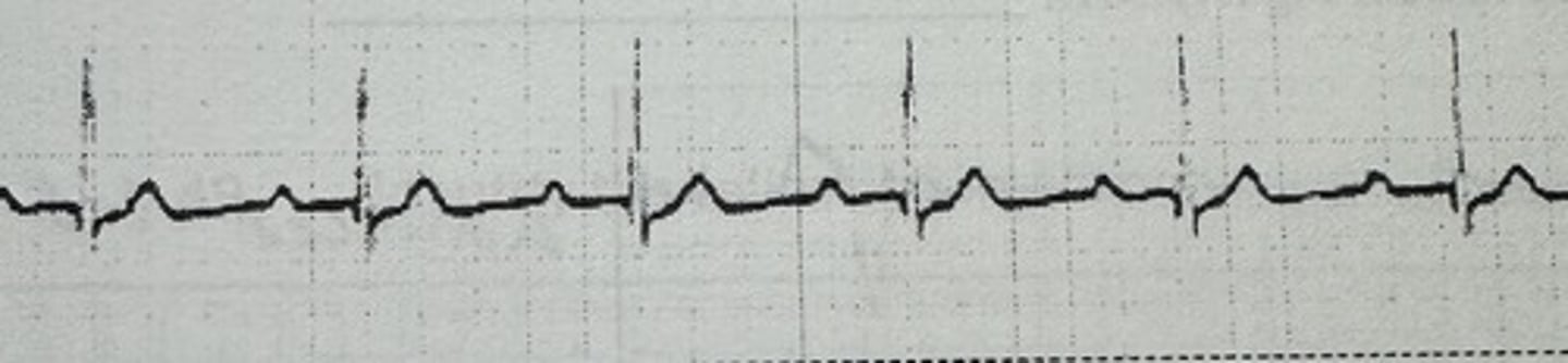 <p>identify the rhythm</p>