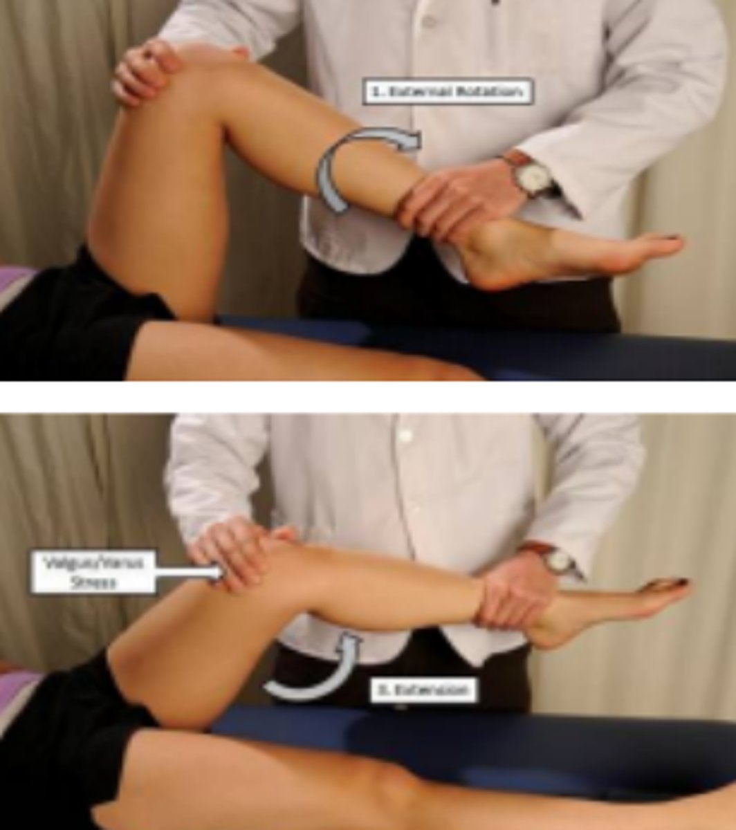 <p>Meniscal tears</p>