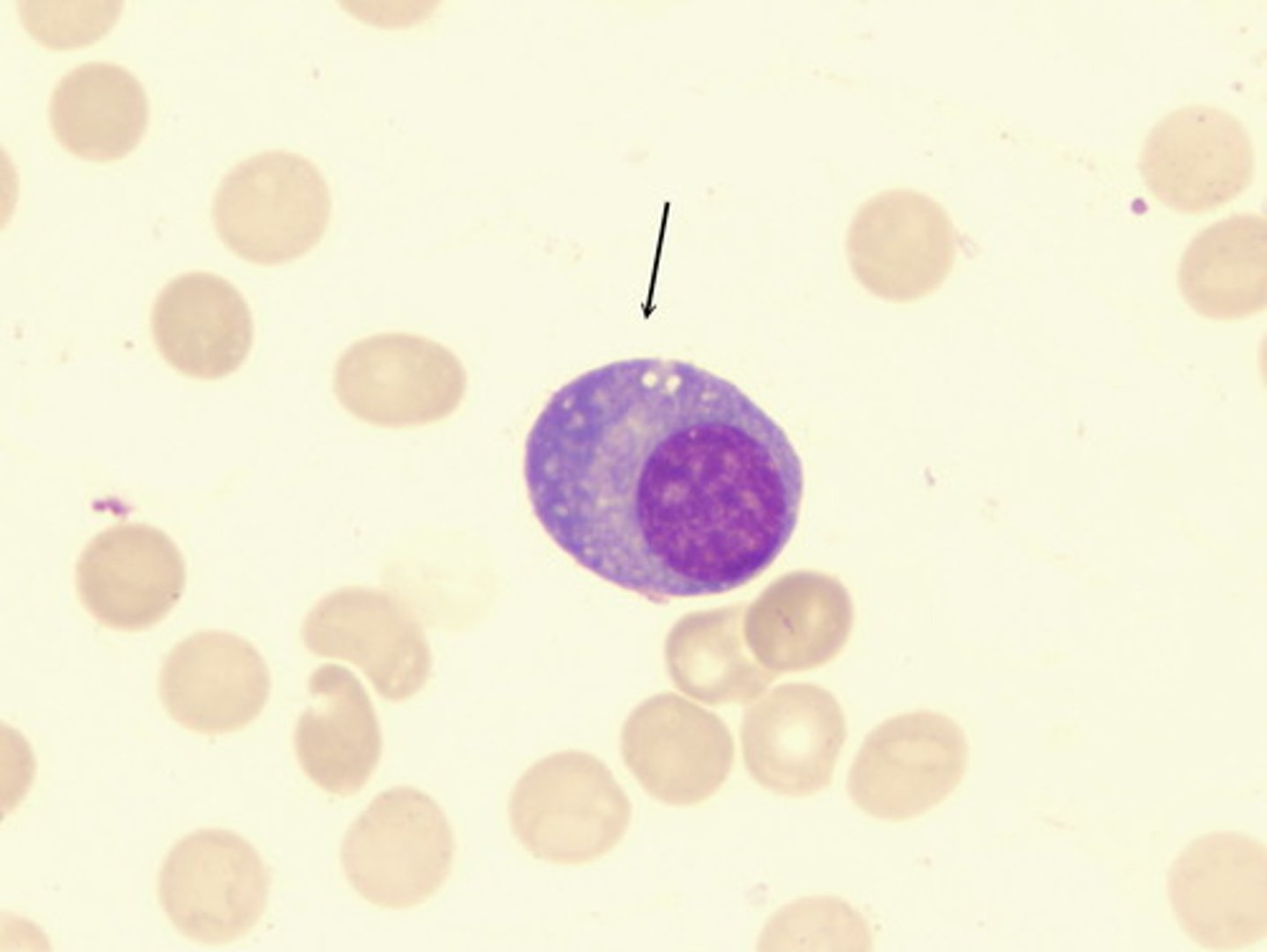 <p>Identify the type of lymphocyte?</p>