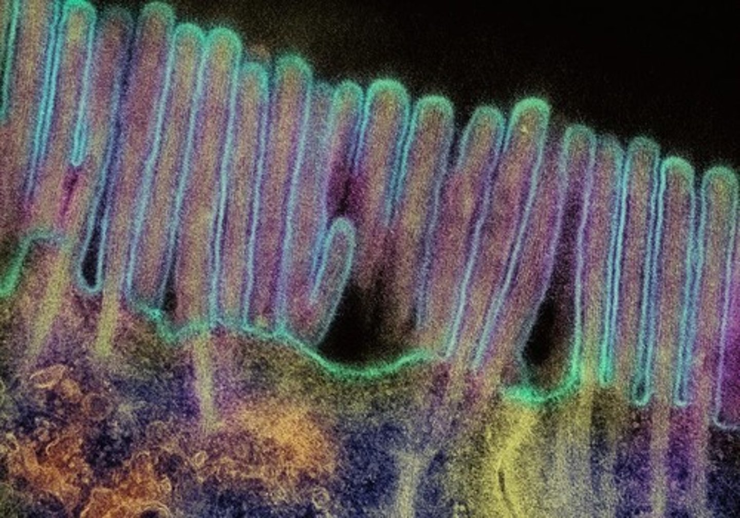 <p>A type of epithelium consisting of a single layer of flat cells.</p>