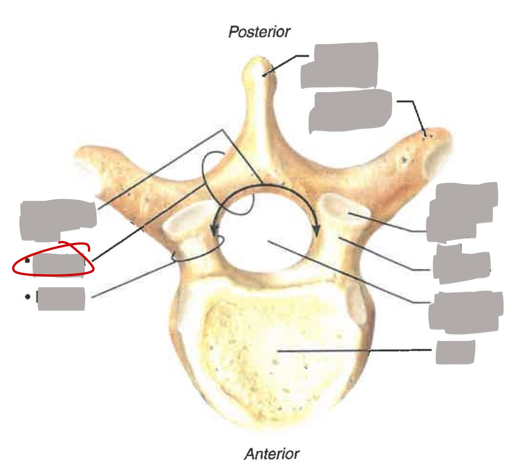 term image