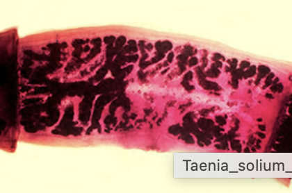 <p>7-13 branches on each side</p>