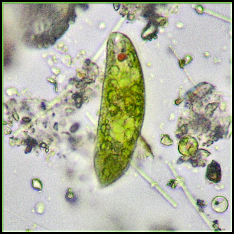 <ul><li><p><strong><em>Fitomastigofora </em></strong>- kanë klorofil, të shpeshta në fitoplankton, me përfaqësues <em><u>Euglena Viridis</u></em></p></li><li><p><strong><em>Zoomastigofora </em></strong>- nuk kanë kloroplaste, lloji <em><u>Trypanosoma Gambiense</u></em> janë parazitë të gjakut të kafshëve dhe njeriut. Ky lloj shkakton <em><u>Sëmundjen e Gjumit</u></em>, sëmundje kjo që manifestohet me temperaturë, rritje të gjëndrave limfatike, anemi (si pasojë e shkatërrimit të eritrociteve) dhe dëshirë e madhe për gjumë.</p></li></ul><p>Këtë parazit e bart miza CC (paraziti depërton në zorrët e mizës, më pas në gjëndra limfatike të saj) duke e thumbuar njeriun dhe i lëshon pështymën e saj të infektuar</p>