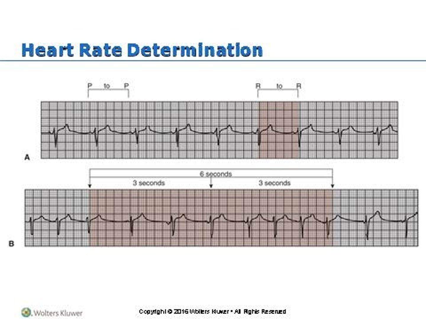 <p>Dizziness, chest pain, shortness of breath, exercise intolerance, cool, clammy skin.</p>
