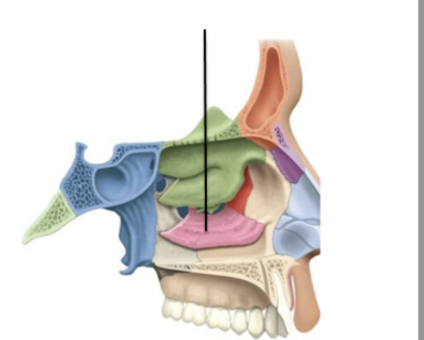 <p>Identify the facial bone and it’s feature(s)</p>
