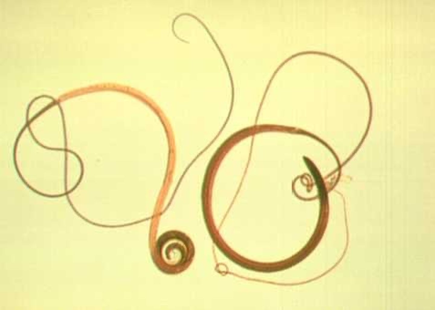 <p>Thin anterior end</p>