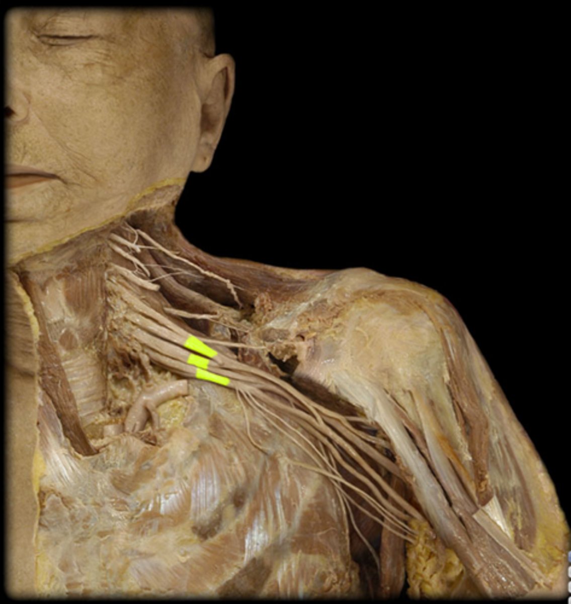 <p>Name the Nerves</p>