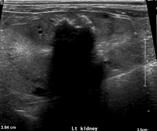 <p>what is creating this shadow</p>