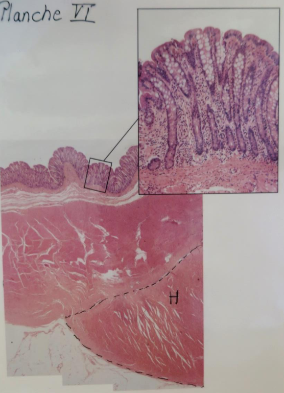 <p>Intestinum crassum, colon</p>