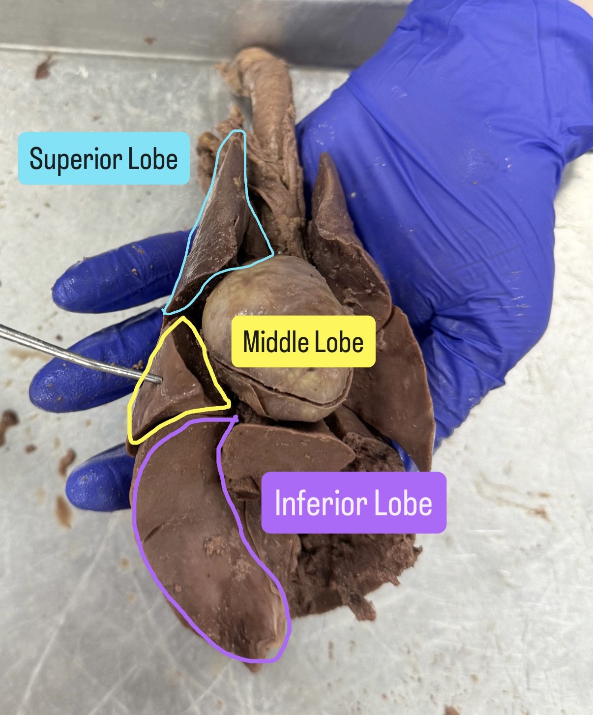 <p>Superior lobe, inferior lobe, middle lobe</p>