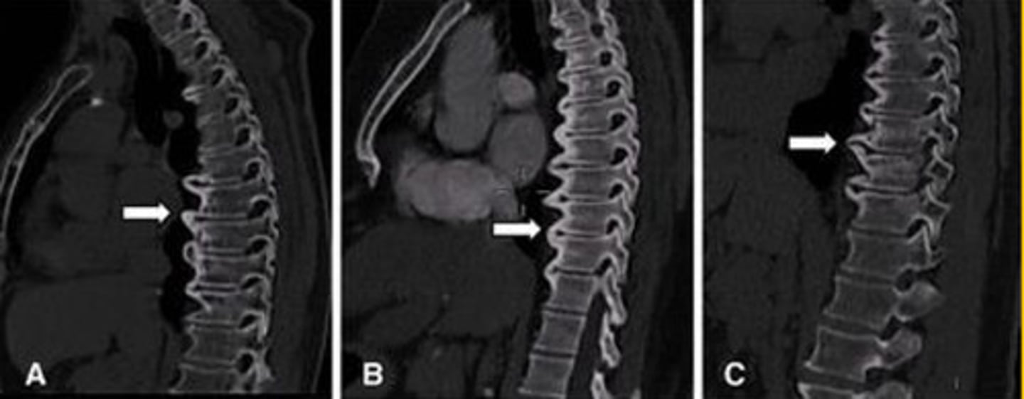 <p>What is the arrow pointing at?</p>