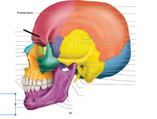 term image