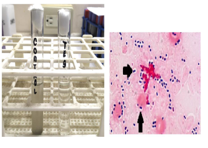 <p>What enzyme produced by this organism is responsible for the result of the test show in the setup?</p>