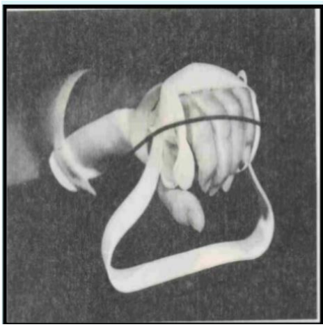 <p>Name this component of a dynamic splint. What’s its function?</p>
