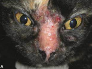 <p>Hipersensibilidad tipo 1 desarollada a la saliva de mosquito. Pápulas eritematosas, erosiones, úlceras, costras, alopecia y alteraciones en pigmentación. Lesiones se presentan en nariz y piel periorbital.</p><p>Dermatitis superficial o profunda, acantolisis en epidermis, erosiones y úlceras.</p>