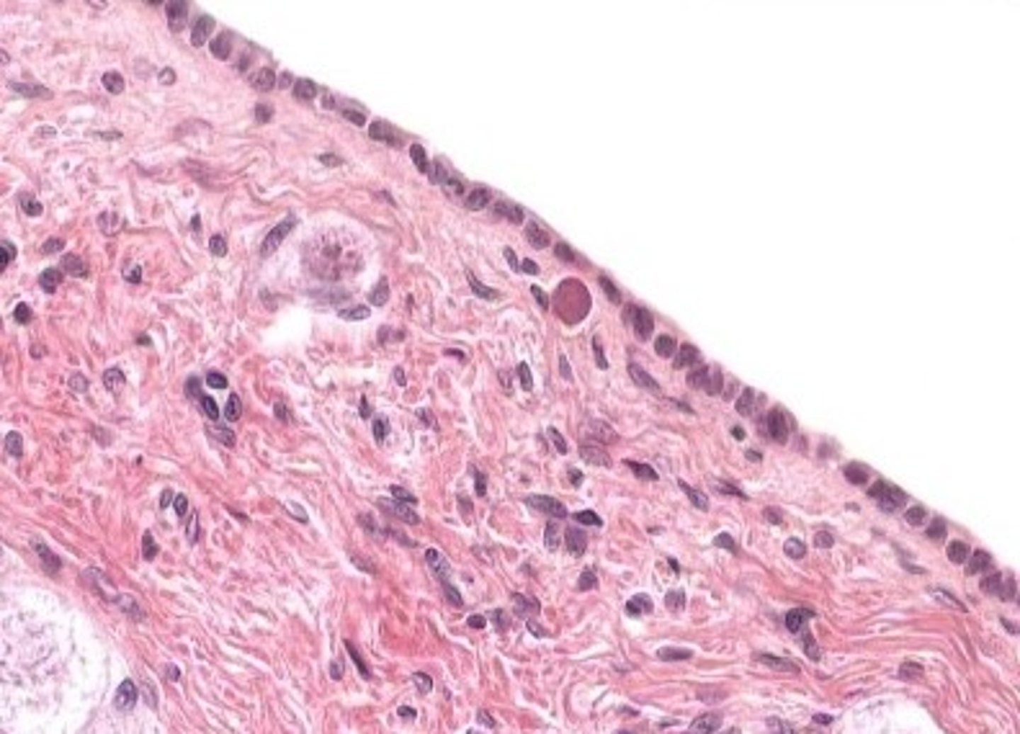 <p>outer surface of the ovary</p>