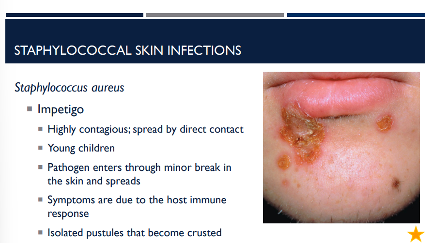 <p>The symptoms of the staphylococcal skin infection impetigo are due to </p>